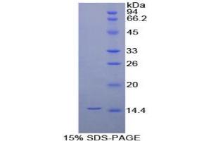 SDS-PAGE of Protein Standard from the Kit (Highly purified E. (IL-8 CLIA Kit)
