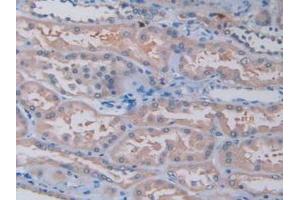Immunohistochemistry (IHC) image for anti-Tryptase alpha/beta 1 (TPSAB1) (AA 161-262) antibody (ABIN7426172)