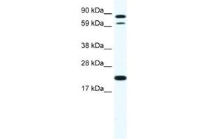 Western Blotting (WB) image for anti-Zinc Finger Protein 287 (ZNF287) antibody (ABIN2461531) (ZNF287 Antikörper)
