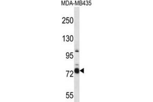 Western Blotting (WB) image for anti-Cas Scaffolding Protein Family Member 4 (CASS4) antibody (ABIN2997369)