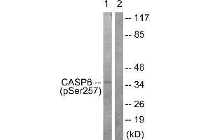 Immunohistochemistry analysis of paraffin-embedded human colon carcinoma tissue using Caspase 6 (Phospho-Ser257) antibody. (Caspase 6 Antikörper  (pSer257))