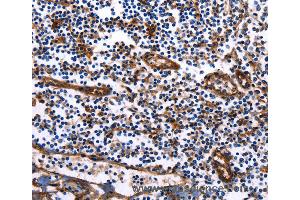 Immunohistochemistry of Human tonsil using DUSP6 Polyclonal Antibody at dilution of 1:25 (DUSP6 Antikörper)