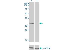 Western blot analysis of FCER1A over-expressed 293 cell line, cotransfected with FCER1A Validated Chimera RNAi (Lane 2) or non-transfected control (Lane 1). (Fc epsilon RI/FCER1A Antikörper  (AA 1-257))