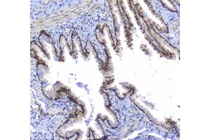 Immunohistochemistry (IHC) image for anti-Splicing Factor 1 (SF1) (AA 160-266) antibody (ABIN5692946)