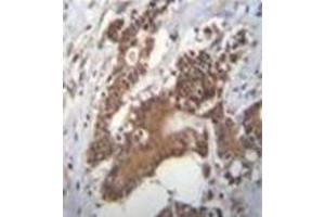 Immunohistochemistry (Paraffin-embedded Sections) (IHC (p)) image for anti-Phosphate Cytidylyltransferase 1, Choline, alpha (PCYT1A) (AA 34-62), (N-Term) antibody (ABIN954057)