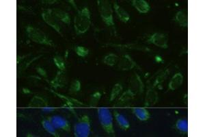 Immunofluorescence analysis of U-2 OS cells using GLUD1 Polyclonal Antibody at dilution of 1:100. (GLUD1 Antikörper)