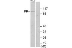 Western blot analysis of extracts from HeLa cells, using Progesterone Receptor (Ab-400) Antibody.