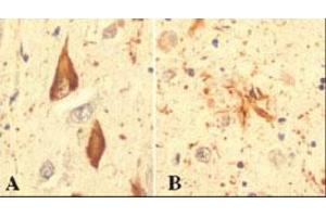 Immunohistochemical staining of RPS27A in hippocampal tissue from an Alzheimer patient, using RPS27A monoclonal antibody, clone Ubi-1 . (RPS27A Antikörper)