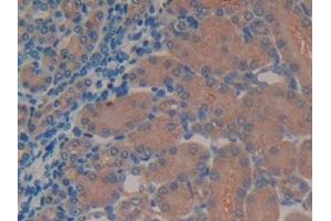 Immunohistochemistry (IHC) image for anti-Transmembrane Protein 27 (TMEM27) (AA 12-222) antibody (ABIN7436798)
