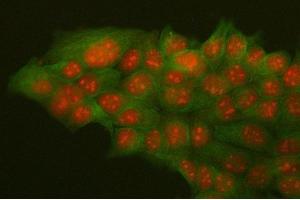 IF analysis of HMGB2 and Tubulin alpha using anti-HMGB2 antibody (ABIN4886620) and anti-Tubulin alpha antibody (ABIN7600339).