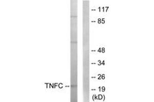 Western blot analysis of extracts from HepG2 cells, using TNFC Antibody. (LTB Antikörper  (AA 181-230))