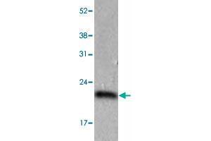 The HeLa (40 ug) were resolved by SDS-PAGE, transferred to PVDF membrane and probed with PPIC monoclonal antibody, clone AT3C6  (1:1000). (PPIC Antikörper  (AA 39-197))
