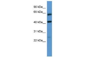 Western Blotting (WB) image for anti-G Protein-Coupled Receptor, Family C, Group 5, Member B (GPRC5B) (N-Term) antibody (ABIN2788217)