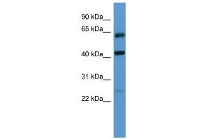 WB Suggested Anti-GPRC5B Antibody Titration: 0.