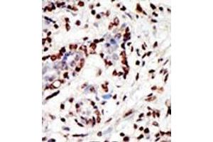 Image no. 1 for anti-Myeloid/lymphoid Or Mixed-Lineage Leukemia (MLL) (C-Term) antibody (ABIN356674) (MLL/KMT2A Antikörper  (C-Term))