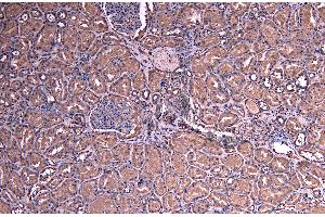 Immunohistochemistry (IHC) image for anti-Suppressor of Cytokine Signaling 1 (SOCS1) (C-Term) antibody (ABIN184575)