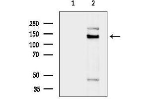Western blot analysis of lysates from Hela cells(heat-shock treatment), using TIMELESS Antibody.