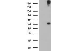 Western Blotting (WB) image for anti-1-Acylglycerol-3-Phosphate O-Acyltransferase 5 (Lysophosphatidic Acid Acyltransferase, Epsilon) (AGPAT5) antibody (ABIN1496498) (AGPAT5 Antikörper)