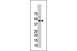 The STRADA polyclonal antibody  is used in Western blot to detect STRADA in mouse brain tissue lysate.