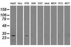Image no. 2 for anti-Replication Protein A2, 32kDa (RPA2) antibody (ABIN1500734) (RPA2 Antikörper)