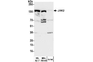 Western Blotting (WB) image for anti-Janus Kinase 2 (JAK2) (AA 1082-1132) antibody (ABIN7454809)