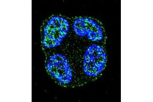 Confocal immunofluorescent analysis of SCUBE2 Antibody (Center ) (ABIN655409 and ABIN2844955) with ZR-75-1 cell followed by Alexa Fluor 488-conjugated goat anti-rabbit lgG (green). (SCUBE2 Antikörper  (AA 251-280))