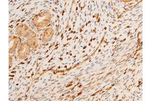 Immunohistochemistry (IHC) image for anti-Tumor Protein P73 (TP73) (pTyr99) antibody (ABIN6256817)