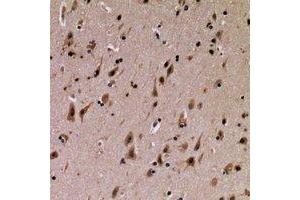 Immunohistochemical analysis of SFT2D3 staining in human brain formalin fixed paraffin embedded tissue section.