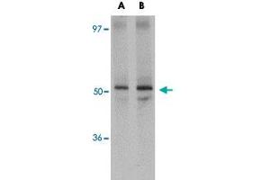 Western blot analysis of JMJD6 in human brain tissue lysate with JMJD6 polyclonal antibody  at (A) 1 and (B) 2 ug/mL .