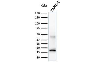 Western Blot Analysis of PANC-1 cell lysate using CELA3B Mouse Monoclonal Antibody (CELA3B/1257). (Elastase 3B Antikörper  (AA 82-238))