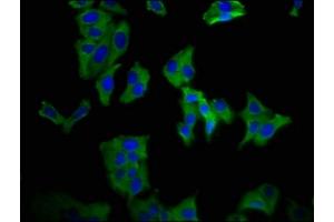 Immunofluorescence staining of HepG2 cells with ABIN7169835 at 1:66, counter-stained with DAPI. (KCNN3 Antikörper  (AA 240-426))