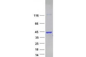 Validation with Western Blot