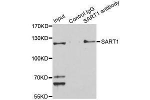 Immunoprecipitation analysis of 150ug extracts of Jurkat cells using 3ug SART1 antibody. (SART1 Antikörper  (AA 1-255))