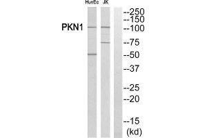Western Blotting (WB) image for anti-Protein Kinase N1 (PKN1) (Internal Region) antibody (ABIN1852725) (PKN1 Antikörper  (Internal Region))