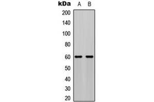 Western blot analysis of AKT (pS473) expression in MCF7 PDGF-treated (A), NIH3T3 PDGF-treated (B) whole cell lysates. (AKT1 Antikörper  (C-Term, pSer473))