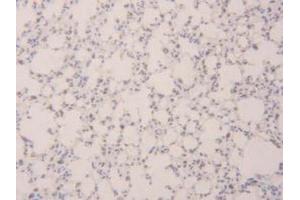 IHC-P analysis of Mouse Lung Tissue, with DAB staining. (SFTPB Antikörper  (AA 20-193))