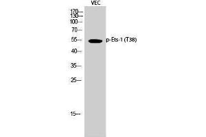 Western Blotting (WB) image for anti-V-Ets erythroblastosis Virus E26 Oncogene Homolog 1 (Avian) (ETS1) (pThr38) antibody (ABIN3179743) (ETS1 Antikörper  (pThr38))