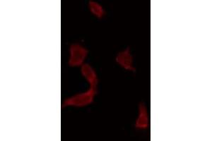 ABIN6269267 staining COS7 by IF/ICC. (YAP1 Antikörper)