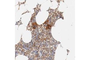Immunohistochemical staining (Formalin-fixed paraffin-embedded sections) of human bone marrow with ZNF267 polyclonal antibody  shows strong cytoplasmic positivity in a subset of bone marrow poietic cells (megakaryocytes). (ZNF267 Antikörper)