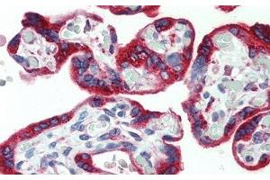 Detection of PDGFAA in Human Placenta Tissue using Monoclonal Antibody to Platelet Derived Growth Factor AA (PDGFAA) (PDGF-AA Homodimer (AA 87-211) Antikörper)