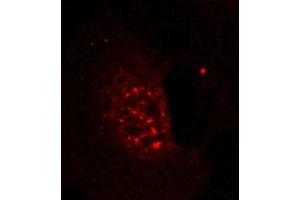 Immunofluorescence staining of methanol-fixed Hela cells showing nuclear dot staining using Akt(Phospho-Thr308) Antibody. (AKT1 Antikörper  (pThr308))