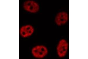 ABIN6276911 staining HepG2? (NR0B2 Antikörper  (Internal Region))