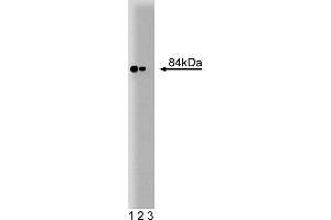 Western Blotting (WB) image for anti-Stromal Interaction Molecule 1 (STIM1) (AA 25-139) antibody (ABIN968271) (STIM1 Antikörper  (AA 25-139))