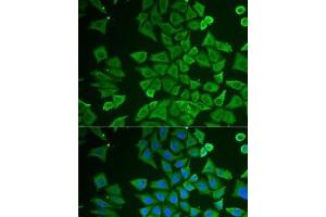 Immunofluorescence analysis of U2OS cells using DDAH2 Polyclonal Antibody (DDAH2 Antikörper)