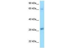 Image no. 1 for anti-Xeroderma Pigmentosum, Complementation Group A (XPA) (C-Term) antibody (ABIN6748095) (XPA Antikörper  (C-Term))