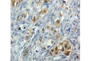IHC-P analysis of Ovary tissue, with DAB staining. (TNFRSF10B Antikörper  (AA 234-435))
