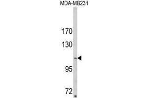 Western blot analysis of ARGBP2 Antibody (N-term) in MDA-MB231 cell line lysates (35ug/lane). (Sorbs2 Antikörper  (N-Term))