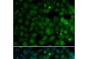 Immunofluorescence analysis of U2OS cells using HPD Polyclonal Antibody (HPD Antikörper)