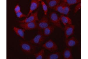 IF analysis of RBMS1 using anti-RBMS1 antibody (ABIN7601195).