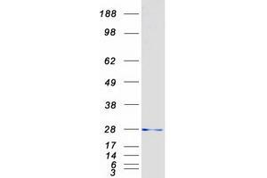 Western Blotting (WB) image for Ubiquitin-Conjugating Enzyme E2S (UBE2S) protein (Myc-DYKDDDDK Tag) (ABIN2712392)